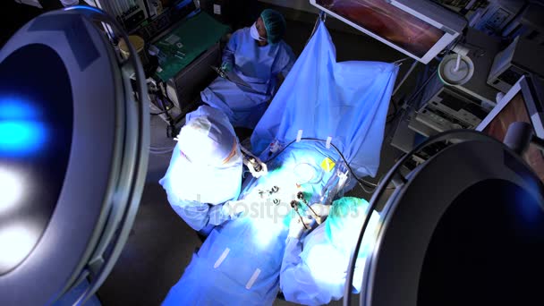 Хирургическая команда, выполняющая лапароскопию — стоковое видео