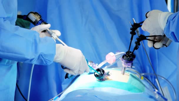 Equipe hospitalar realizando operação de laparoscopia — Vídeo de Stock