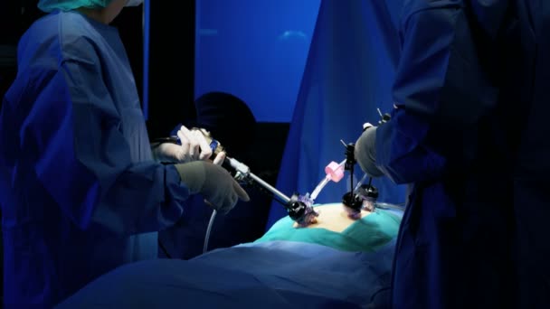 Treinamento em saúde realizando operação laparoscópica — Vídeo de Stock