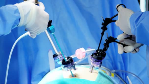 Kirurgisk operation utförs av kirurger — Stockvideo