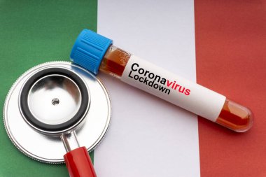 CORONAVIRUS LOCKKDOWN metin, steteskop ve İtalya bayrakları üzerinde kan örneği vakum tüpü. Covid-19 veya Coronavirus Kavramı 