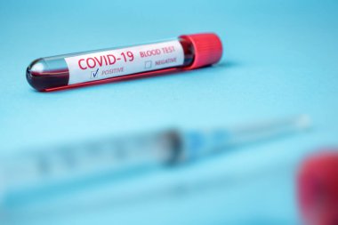 Coronavirus covid-19 numune tüpündeki kan örneğini enfekte etti. Coronavirus covid-19 aşı araştırması. Hastane kavramı. Klinik geçmişi. Salgın, salgın geçmişi. Teşhis