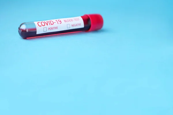 Blodprov för positivt eller negativt resultat. Coronavirus Disease 2019 blodanalyserande koncept. Provrör med blodprov för Covid-19. Positiv eller negativ. Ny sjukdom: Covid-19 — Stockfoto