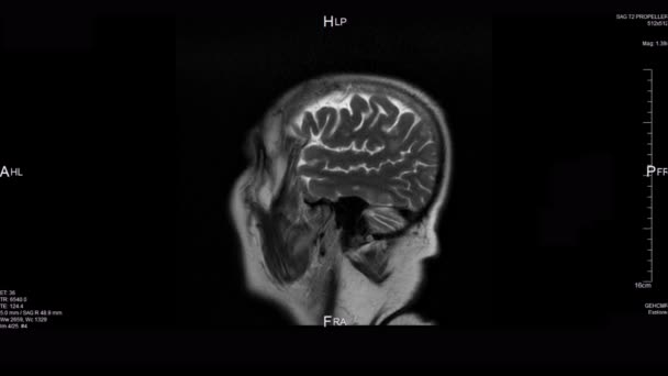 超音波 X線人間の頭部スキャン — ストック動画