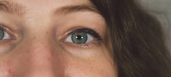 Mulher com saco de olho embaixo. Olho Puffy da menina que mostra sacos dos olhos. Mulheres olho close-up. — Fotografia de Stock