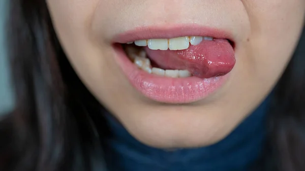 Vrouwelijke mond close-up, vrouw toont tong. Vrouw bijt in haar tong — Stockfoto