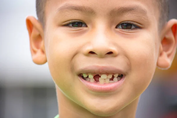 Zęby Dziecka Prostu Wrzucone Ust Zdjęcia Stockowe bez tantiem