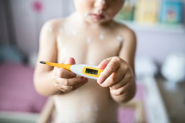 Little girl with chickenpox, holding thermometer — Stock Photo, Image