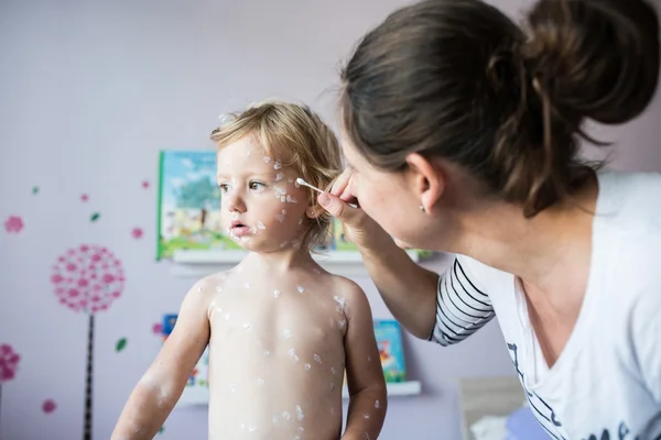 Niña con varicela y madre — Foto de Stock