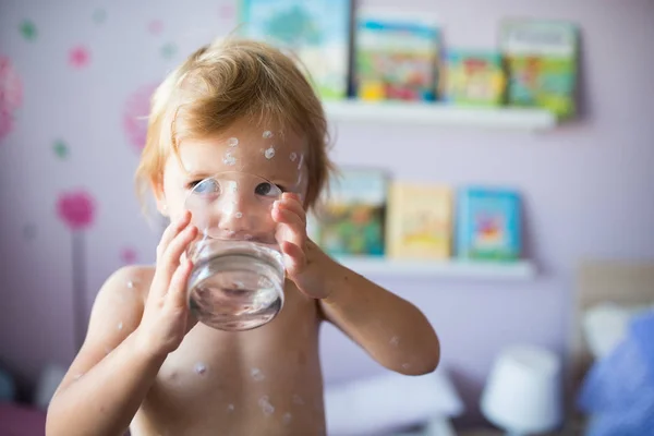 Little girl with chickenpox, drinking water from glass — Stock Photo, Image