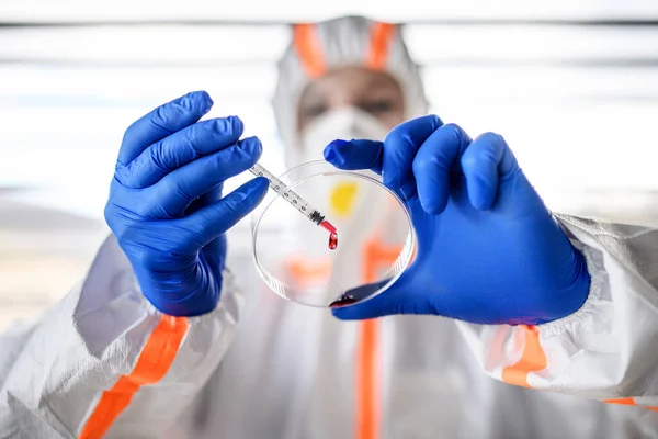 Front view of doctor analyzing blood samples, coronavirus concept. — Stockfoto