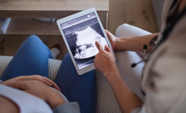 Unrecognizable healthcare worker with ultrasound on tablet and pregnant woman.