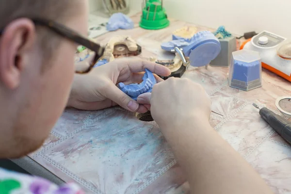 Zubař pracuje s dentální plísní na klinice — Stock fotografie