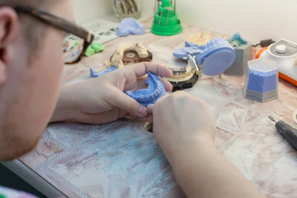 Стоматолог, работающий с зубной плесенью в клинике — стоковое фото