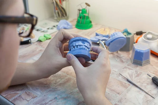 Dentist working with dental mold at clinic — Stock Photo, Image