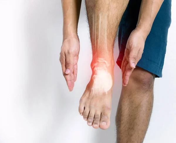 Inflammation Bone Ankle Humans Inflammation — Stock Photo, Image
