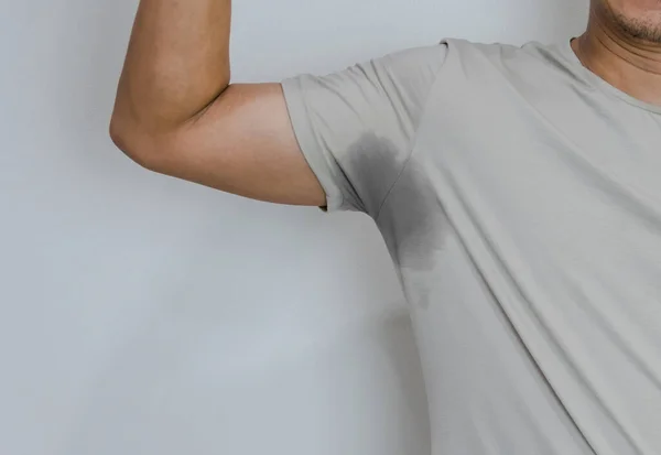 Men Sweating Armpit Has Body Odor — Stock Photo, Image