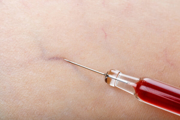 Injection treatment on human skin