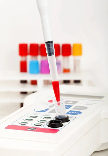 Blood sample test — Stock Photo, Image