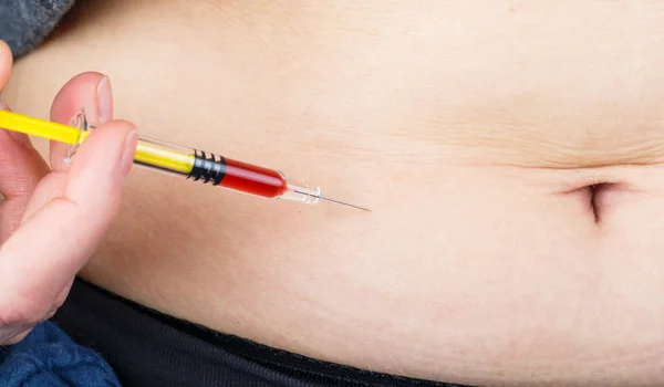 腹部的胰岛素注射液 — 图库照片
