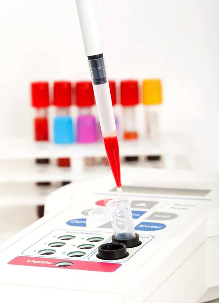 Badanie próbki krwi — Zdjęcie stockowe