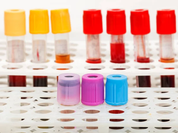 Blood sample tubes — Stock Photo, Image