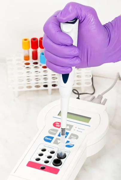 Blood sample analysis — Stock Photo, Image