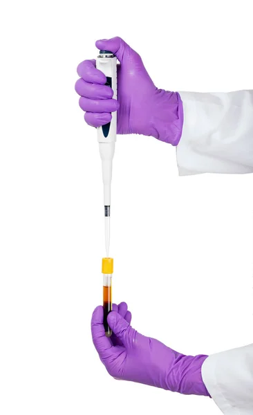 Doctor using pipette for blood sample examination — Stock Photo, Image