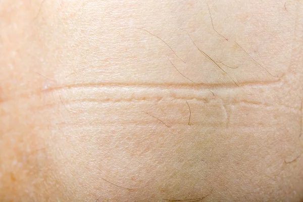 Textura de piel humana — Foto de Stock
