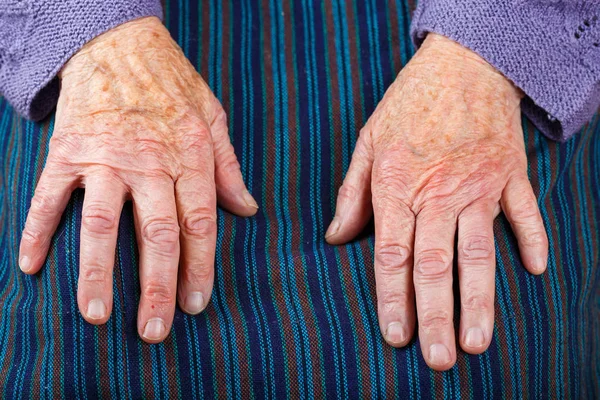 Las manos de las mujeres mayores — Foto de Stock