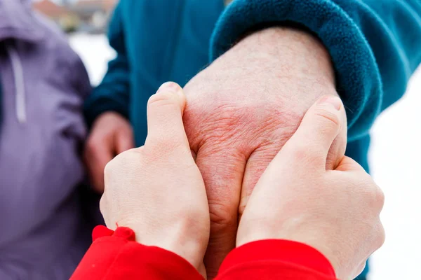 Hjälpande händer — Stockfoto