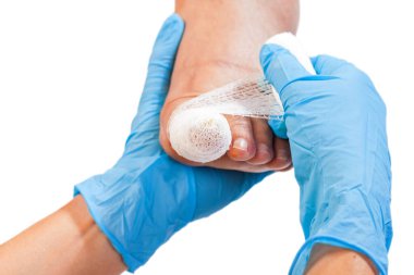 Close up photo of bandaged injured toenail on isolated white background clipart