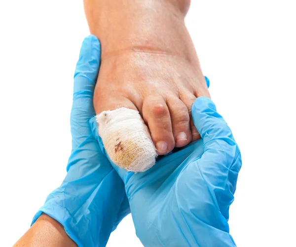 Nahaufnahme Foto Des Bandagierten Verletzten Zehennagels Auf Isoliertem Weißen Hintergrund — Stockfoto