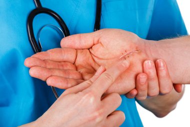 Doktor avuç içindeki cerrahi dikişleri inceliyor.
