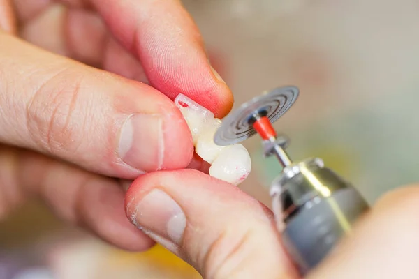 Foto Ravvicinata Odontotecnico Che Lavora Una Corona Denti — Foto Stock