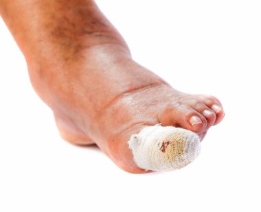 Close up photo of bandaged injured toenail on isolated white background clipart