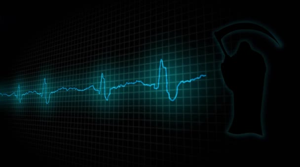 Attask szív. A beteg szív cardiogram — Stock videók