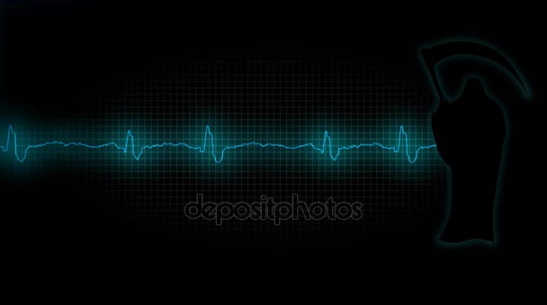 Attaque cardiaque. Cardiogramme d'un cœur malade 