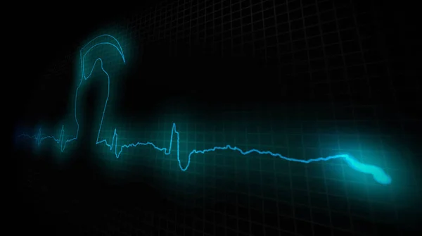 Attask szív. A beteg szív cardiogram — Stock Fotó