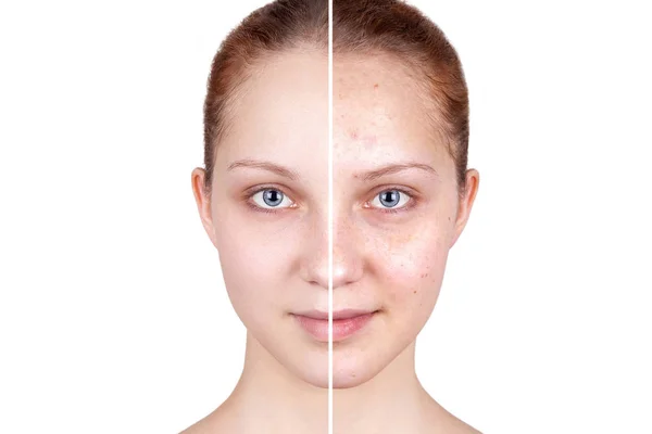 Befor and after treatment. — Stock Photo, Image