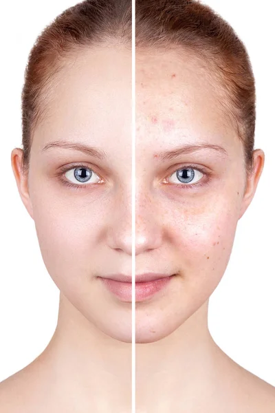 Befor and after treatment. — Stock Photo, Image