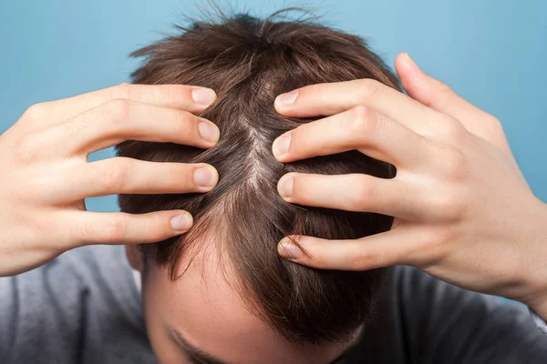 Closeup of young man showing clean scalp and washed brown health — Stock Photo, Image