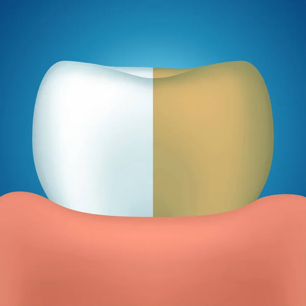 Zahn auf blau — Stockvektor