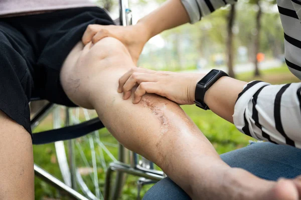 Mão de perto do fisioterapeuta feminino verificar perna e joelho da mulher idosa asiática em cadeira de rodas, idosos sofrem de músculos doloridos, recebendo uma massagem nas pernas, fisiologia pressionando com os dedos para relaxar — Fotografia de Stock