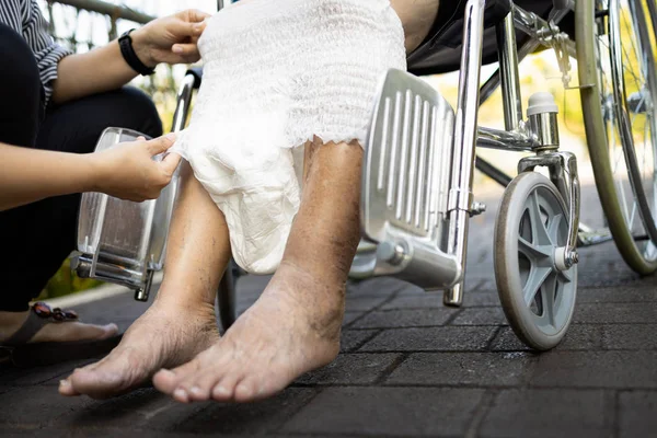 Hand of woman giving adult diaper change at nursing home,asian s