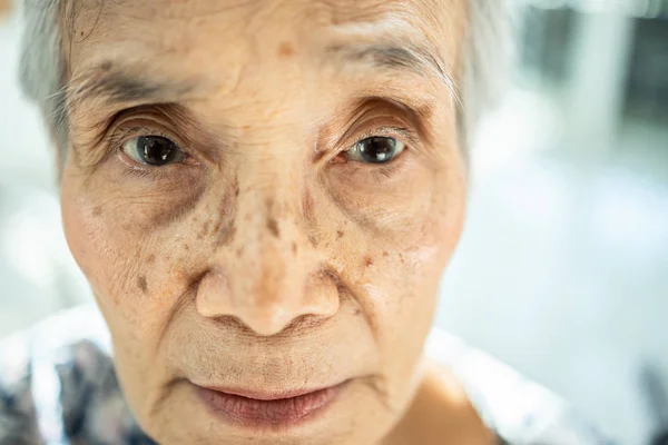 Erschöpfte asiatische Seniorin leidet unter Schlaflosigkeit — Stockfoto