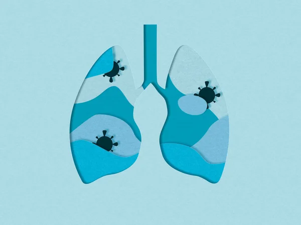 Illustration von zerschnittenen Lungen mit Viren. Lungenentzündung. Covid-19-Coronavirus-Pandemie — Stockfoto