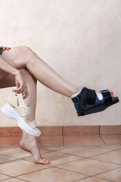 Kadın bacakları, biri bandajlı ve ameliyat sonrası ortopedik çizmeli. Dar ayakkabılar, ayak parmağında deformasyon, metatarsofageal eklem, hallux valgus ya da nasır oluşması sonucu oluşmuş. Boşluğu kopyala.