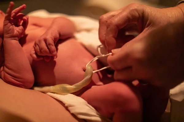 Sujeción del cordón umbilical después del nacimiento — Foto de Stock