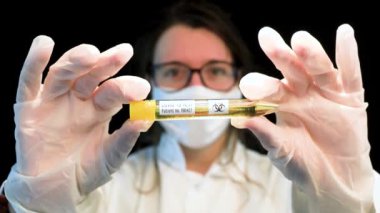 Hemşire Corona gribi örneklerini tutuyor.